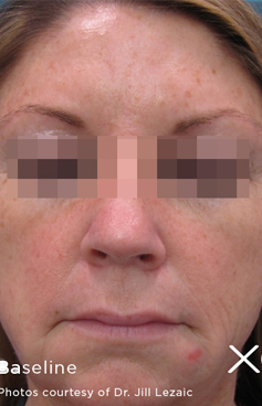 Before - Oatlands Aesthetics